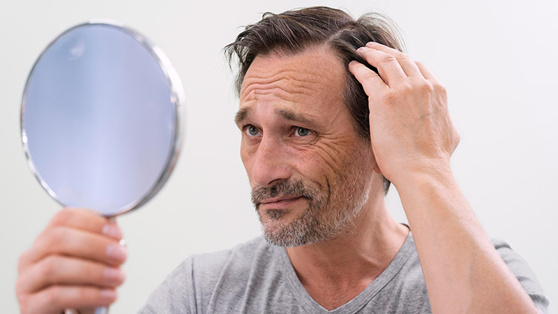 Hair Loss vs Hair Shedding
